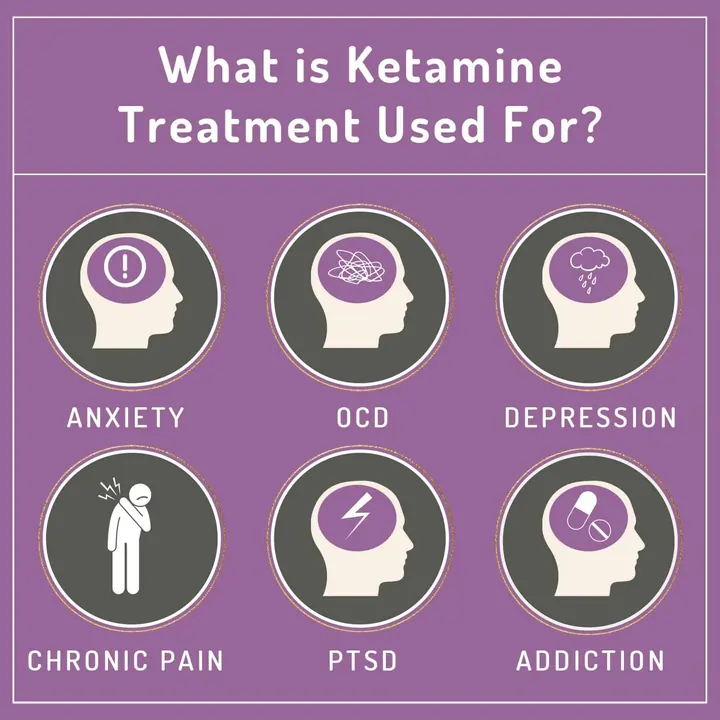 How Fast Does Ketamine Work for Anxiety?