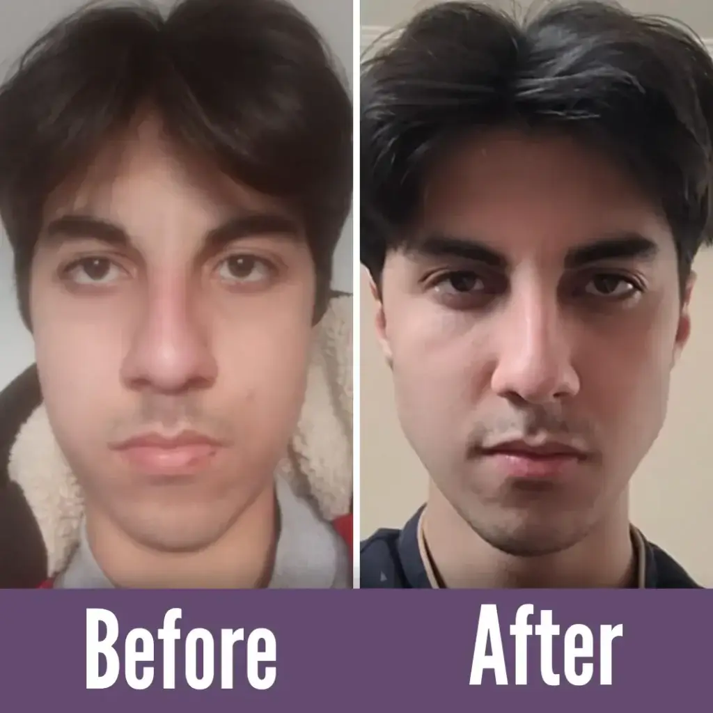 face yoga before and after
